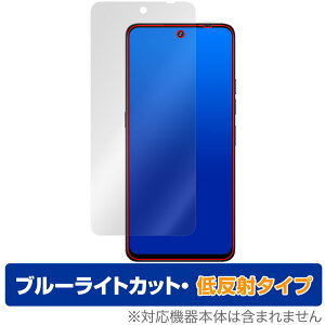 UMIDIGI Note 100 5G ی tB OverLay Eye Protector ᔽ for ~fBW X}[gtH tی u[CgJbg ˖h~