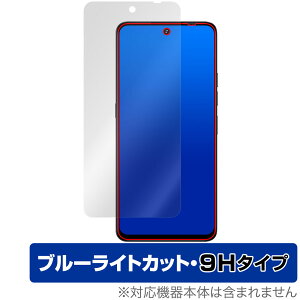 UMIDIGI Note 100 5G ی tB OverLay Eye Protector 9H for ~fBW X}[gtH tی 9H dx u[CgJbg