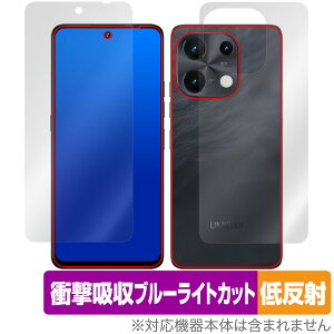UMIDIGI Note 100 5G \ w یtB OverLay Absorber ᔽ for ~fBW X}[gtH Ռz u[CgJbg R