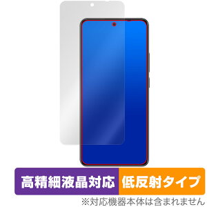 Xiaomi Redmi Note 14 5G ی tB OverLay Plus Lite for VI~[ X}[gtH ׉tΉ A`OA wh~