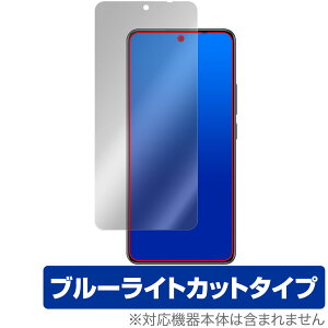 Xiaomi Redmi Note 14 5G ی tB OverLay Eye Protector for VI~[ X}[gtH tی ڂɗD u[CgJbg