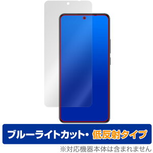 Xiaomi Redmi Note 14 5G ی tB OverLay Eye Protector ᔽ for VI~[ X}[gtH u[CgJbg ˖h~