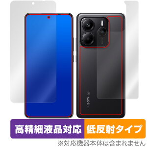 Xiaomi Redmi Note 14 5G \ w tB OverLay Plus Lite for VI~[ X}[gtH ׉tΉ A`OA wh~
