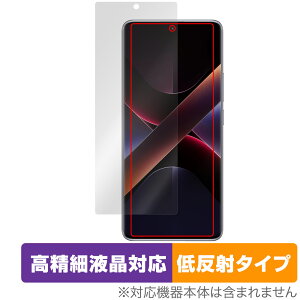 Xiaomi POCO X7 ی tB OverLay Plus Lite for VI~[ X}[gtH |R ׉tΉ A`OA ˖h~ wh~