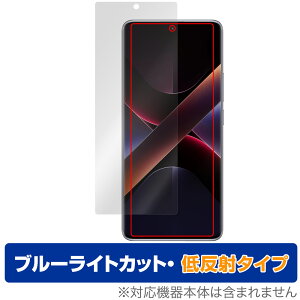 Xiaomi POCO X7 ی tB OverLay Eye Protector ᔽ for VI~[ X}[gtH |R tی u[CgJbg ˖h~