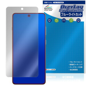 OnePlus 13R ی tB OverLay Eye Protector for vX X}[gtH tی ڂɗD u[CgJbg