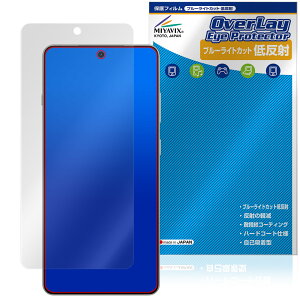 OnePlus 13R ی tB OverLay Eye Protector ᔽ for vX X}[gtH tی u[CgJbg ˖h~