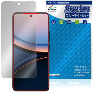 Xiaomi POCO F7 Ultra ی tB OverLay Eye Protector for VI~[ |R tی ڂɗD u[CgJbg