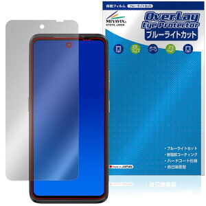 Ulefone Armor 23 Ultra �ی� �t�B���� OverLay Eye Protector for �E���t�H�� �X�}�[�g�t�H�� �t���ی� �ڂɗD���� �u���[���C�g�J�b�g