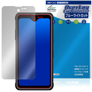 Phonemax R4 GT / R4 T ی tB OverLay Eye Protector for X}[gtH tی ڂɗD u[CgJbg