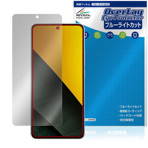 Xiaomi POCO M7 Pro 5G یtB OverLay Eye Protector for VI~[ X}[gtH |R ڂɗD u[CgJbg