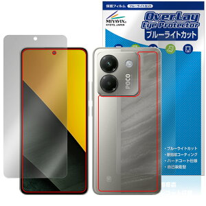 Xiaomi POCO M7 Pro 5G \ w tB OverLay Eye Protector for VI~[ X}[gtH |R ڂɗD u[CgJbg