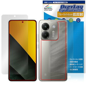 Xiaomi POCO M7 Pro 5G \ w tB OverLay Eye Protector ᔽ for VI~[ X}[gtH |R u[CgJbg