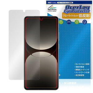 realme GT7 Pro Racing Edition ی tB OverLay Eye Protector ᔽ for A~[ W[eB[ u[CgJbg ˖h~