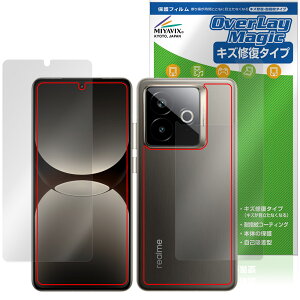 realme GT7 Pro Racing Edition \ w tB OverLay Magic for A~[ W[eB[ C ώw wh~ R[eBO