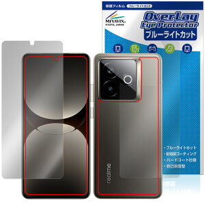 realme GT7 Pro Racing Edition \ w tB OverLay Eye Protector for A~[ W[eB[ ڂɗD u[CgJbg