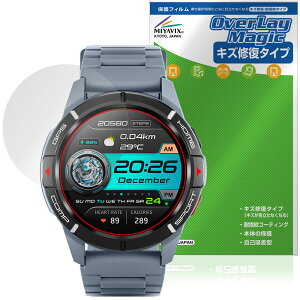 Mibro Watch GS Active ی tB OverLay Magic for ~u X}[gEHb` C ώw wh~ R[eBO