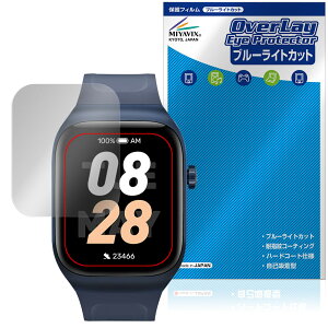 Mibro Watch T2 ی tB OverLay Eye Protector for ~u X}[gEHb` tی ڂɗD u[CgJbg