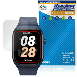Mibro Watch T2 �ی� �t�B���� OverLay Eye Protector �ᔽ�� for �~�u�� �X�}�[�g�E�H�b�` �t���ی� �u���[���C�g�J�b�g ���˖h�~
