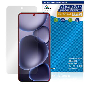 OPPO Find X8 Ultra ی tB OverLay Eye Protector ᔽ for Ib| X}[gtH tی u[CgJbg ˖h~