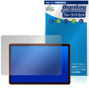 Callsky Ctab 10 ی tB OverLay Eye Protector for AhCh ^ubg tی ڂɗD u[CgJbg