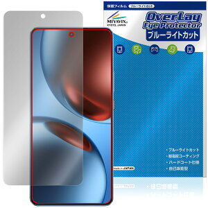 realme GT7 ی tB OverLay Eye Protector for A~[ X}[gtH W[eB[ tی ڂɗD u[CgJbg