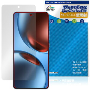 realme GT7 ی tB OverLay Eye Protector ᔽ for A~[ X}[gtH W[eB[ u[CgJbg ˖h~