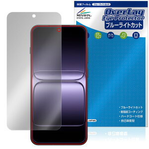 OnePlus 13T ی tB OverLay Eye Protector for vX X}[gtH tی ڂɗD u[CgJbg