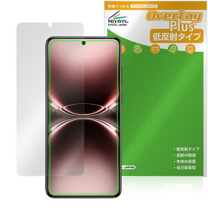 vivo X200 Ultra �ی� �t�B���� OverLay Plus for ���B�[���H �G�b�N�X �t���ی� �A���`�O���A ���˖h�~ ����� �w��h�~