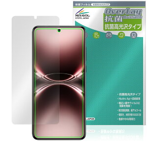 vivo X200 Ultra �ی� �t�B���� OverLay �R�� Brilliant for ���B�[���H �G�b�N�X Hydro Ag+ �R�� �R�E�C���X ������