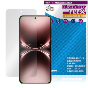 vivo X200 Ultra �ی� �t�B���� OverLay FLEX �ᔽ�� for ���B�[���H �G�b�N�X �t���ی� �ȖʑΉ� �_��f�� ���˖h�~ �Ռ��z��