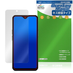 SOYES F9 Max ی tB OverLay Magic for X}[gtH tی C ώw wh~ R[eBO