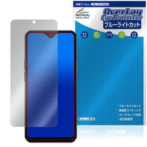 SOYES F9 Max �ی� �t�B���� OverLay Eye Protector for �X�}�[�g�t�H�� �t���ی� �ڂɗD���� �u���[���C�g�J�b�g