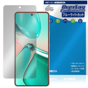 ASUS ZenFone 12 Ultra ی tB OverLay Eye Protector for GCX[X [tH tی ڂɗD u[CgJbg