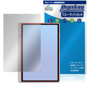 XP-PEN Magic Note Pad ی tB OverLay Eye Protector for GbNXs[y m[gpbh tی u[CgJbg
