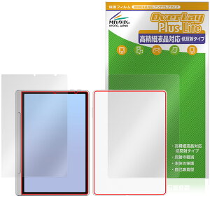 XP-PEN Magic Note Pad \ w tB OverLay Plus Lite for GbNXs[y m[gpbh ׉tΉ A`OA wh~