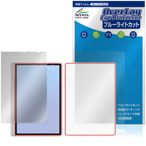 XP-PEN Magic Note Pad \ w tB OverLay Eye Protector for GbNXs[y m[gpbh ڂɗD u[CgJbg