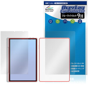 XP-PEN Magic Note Pad \ w tB OverLay Eye Protector 9H for GbNXs[y m[gpbh 9H dx u[CgJbg