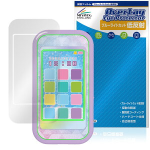 Ђ݂̃ACvX}zR ی tB OverLay Eye Protector ᔽ for ^Jg~[ dqߋ tی u[CgJbg ˖h~