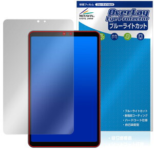 ALLDOCUBE iPlay 70 mini Pro ی tB OverLay Eye Protector for I[hL[u ACvC ڂɗD u[CgJbg