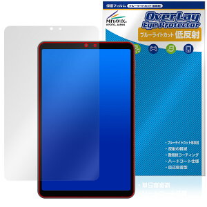 ALLDOCUBE iPlay 70 mini Pro ی tB OverLay Eye Protector ᔽ for I[hL[u ACvC u[CgJbg ᔽ