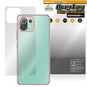 Xiaomi Mi 11 Lite 5G w ی tB OverLay Plus Premium for VI~ {̕یtB 炳G ᔽˑf