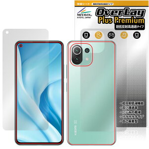 Xiaomi Mi 11 Lite 5G \ w tB OverLay Plus Premium for VI~ \ʁEwʃZbg A`OA ˖h~  wh~