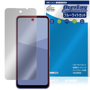 AQUOS wish5 ی tB OverLay Eye Protector for V[v ANIX EBbV tی ڂɗD u[CgJbg