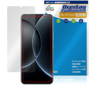 Xiaomi 15S Pro �ی� �t�B���� OverLay Eye Protector �ᔽ�� for �V���I�~�[ �X�}�[�g�t�H�� �t���ی� �u���[���C�g�J�b�g ���˖h�~