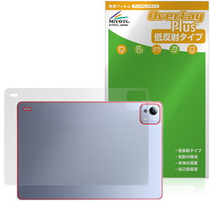 Xiaomi Pad 7 Ultra 14C` w ی tB OverLay Plus for VI~[ ^ubg {̕یtB 炳G ᔽˑf