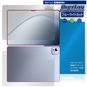Xiaomi Pad 7 Ultra 14C` \ w tB OverLay Eye Protector for VI~[ ^ubg ڂɗD u[CgJbg