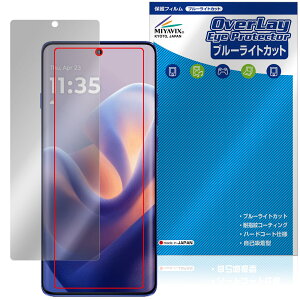 motorola edge 60 pro 60s Pro ی tB OverLay Eye Protector for g[ GbW ڂɗD u[CgJbg