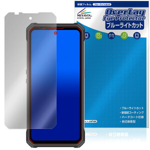 OUKITEL WP100 �ی� �t�B���� OverLay Eye Protector for �I�E�L�e�� �X�}�[�g�t�H�� �t���ی� �ڂɗD���� �u���[���C�g�J�b�g