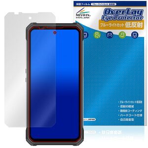 OUKITEL WP100 �ی� �t�B���� OverLay Eye Protector �ᔽ�� for �I�E�L�e�� �X�}�[�g�t�H�� �t���ی� �u���[���C�g�J�b�g ���˖h�~